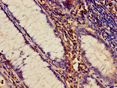 CSB-PA001273LA01HU
