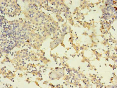 CSB-PA001273LA01HU