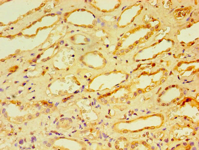 CSB-PA004367YA01HU