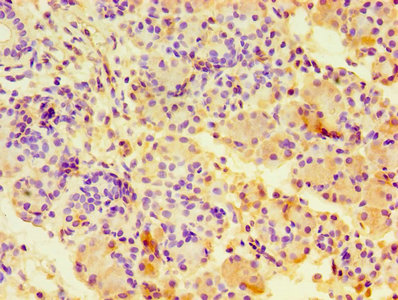 CSB-PA004367YA01HU