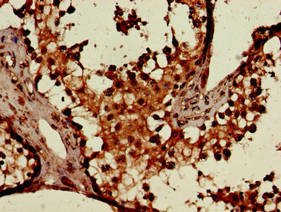 CSB-PA006046LA01HU