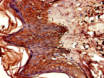 CSB-PA006046LA01HU