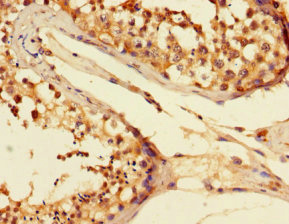 CSB-PA007831LA01HU