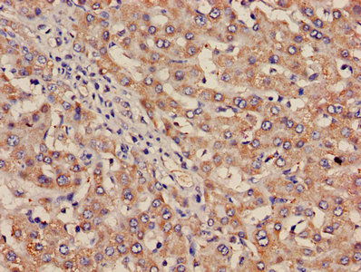 CSB-PA011865LA01HU