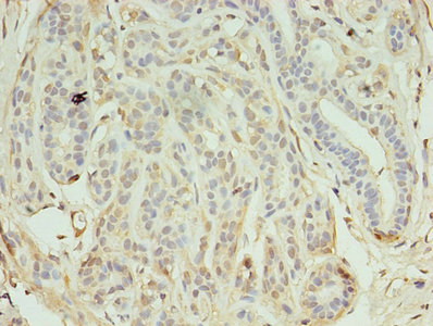 CSB-PA012147LA01HU