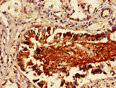 CSB-PA012721LA01HU