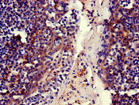 CSB-PA013754LA01HU