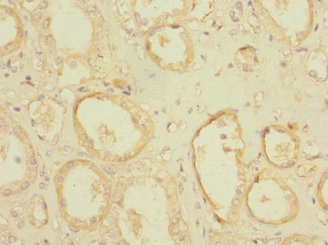 CSB-PA018298LA01HU
