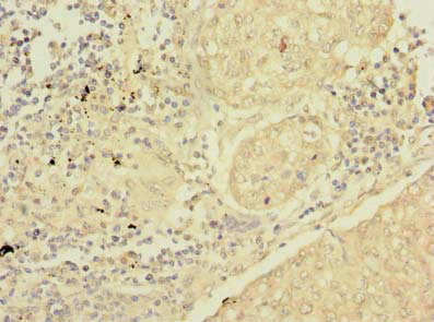 CSB-PA021174LA01HU