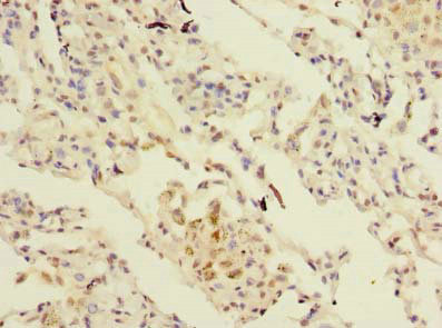 CSB-PA021174LA01HU