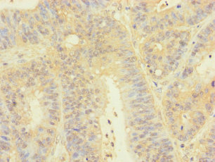 CSB-PA023449LA01HU
