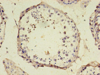 CSB-PA525638LA01HU