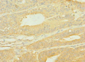 CSB-PA622519LA01HU
