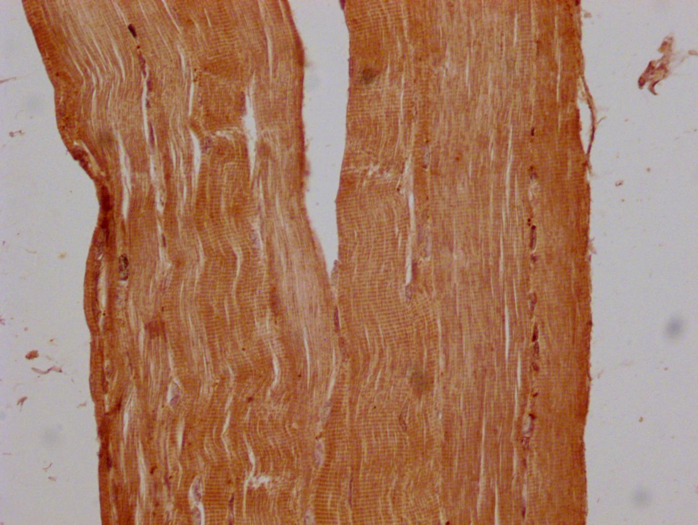 CSB-PA755482LA01HU