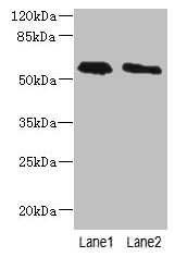 CSB-PA839298LA01HU