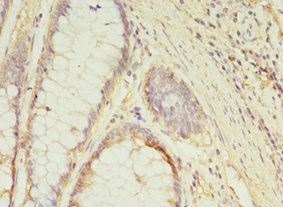 CSB-PA846598LA01HU