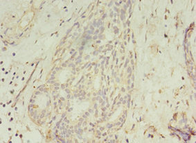 CSB-PA846598LA01HU