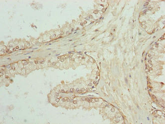 CSB-PA865142LA01HU