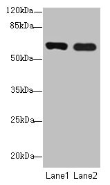CSB-PA865142LA01HU