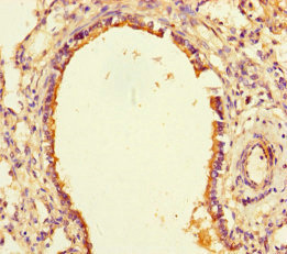 CSB-PA867155LA01HU