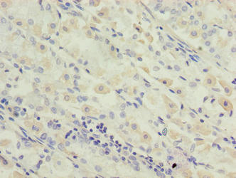 CSB-PA868340LA01HU
