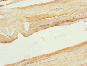 CSB-PA871381LA01HU