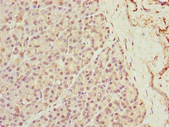 CSB-PA871381LA01HU