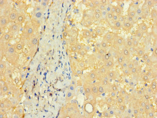 CSB-PA880954LA01HU