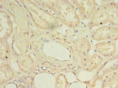 CSB-PA882080LA01HU