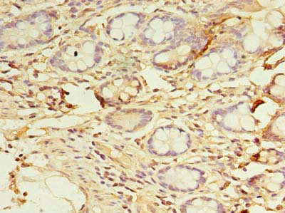 CSB-PA882080LA01HU