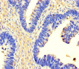CSB-PA896756LA01HU