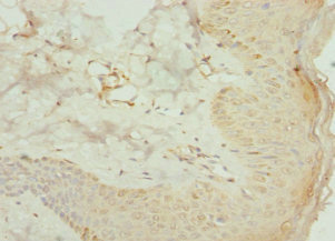 CSB-PA001450ESR2HU