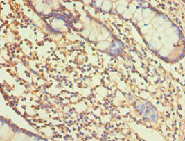 CSB-PA001565ESR1HU