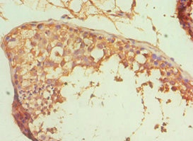 CSB-PA001565ESR1HU