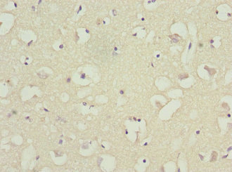 CSB-PA002678ESR1HU
