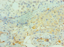 CSB-PA002700ESR1HU