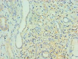 CSB-PA002700ESR1HU