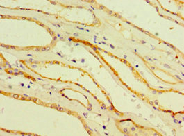 CSB-PA005041ESR1HU