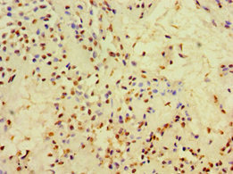 CSB-PA005271ESR2HU