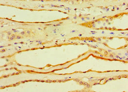CSB-PA005271ESR2HU