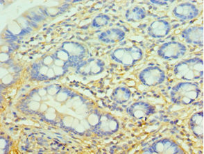 CSB-PA005273ESR2HU
