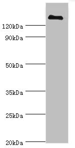 CSB-PA005273ESR2HU