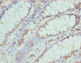 CSB-PA005616ESR2HU