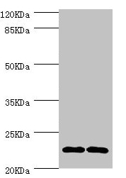 CSB-PA005616ESR2HU