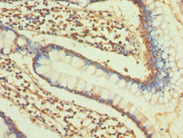CSB-PA005739ESR2HU