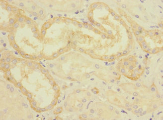 CSB-PA005983ESR1HU