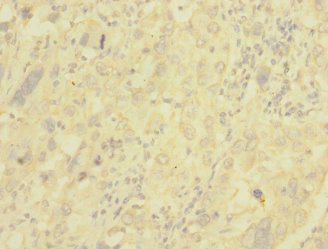 CSB-PA006076ESR1HU