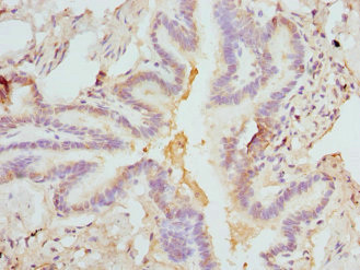 CSB-PA008550ESR1HU