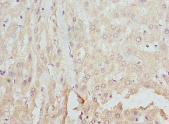 CSB-PA008550ESR1HU