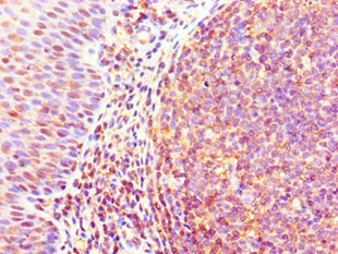 CSB-PA009443ESR2HU